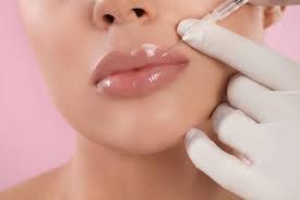 Natural Lip Fillers