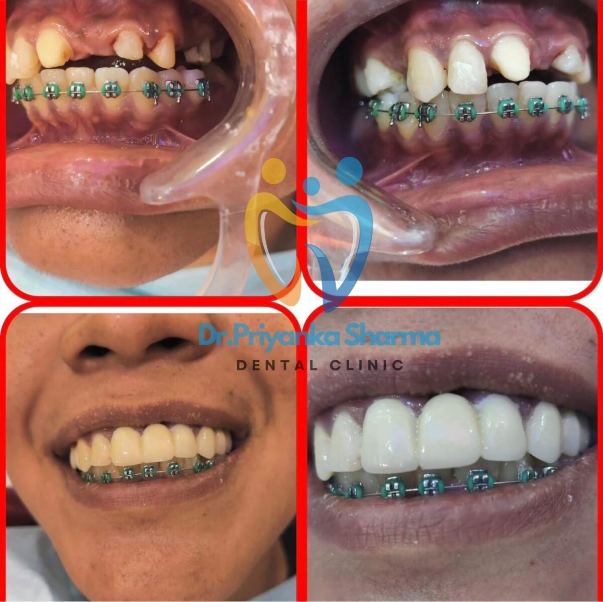 Dr Priyanka Dental Clinic